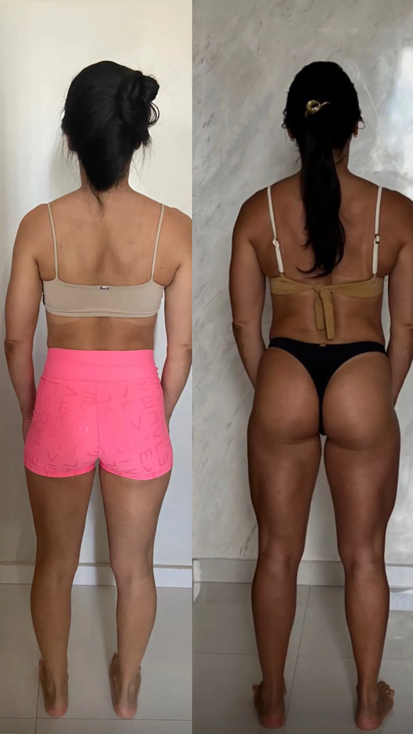 Andréa — antes e depois real
