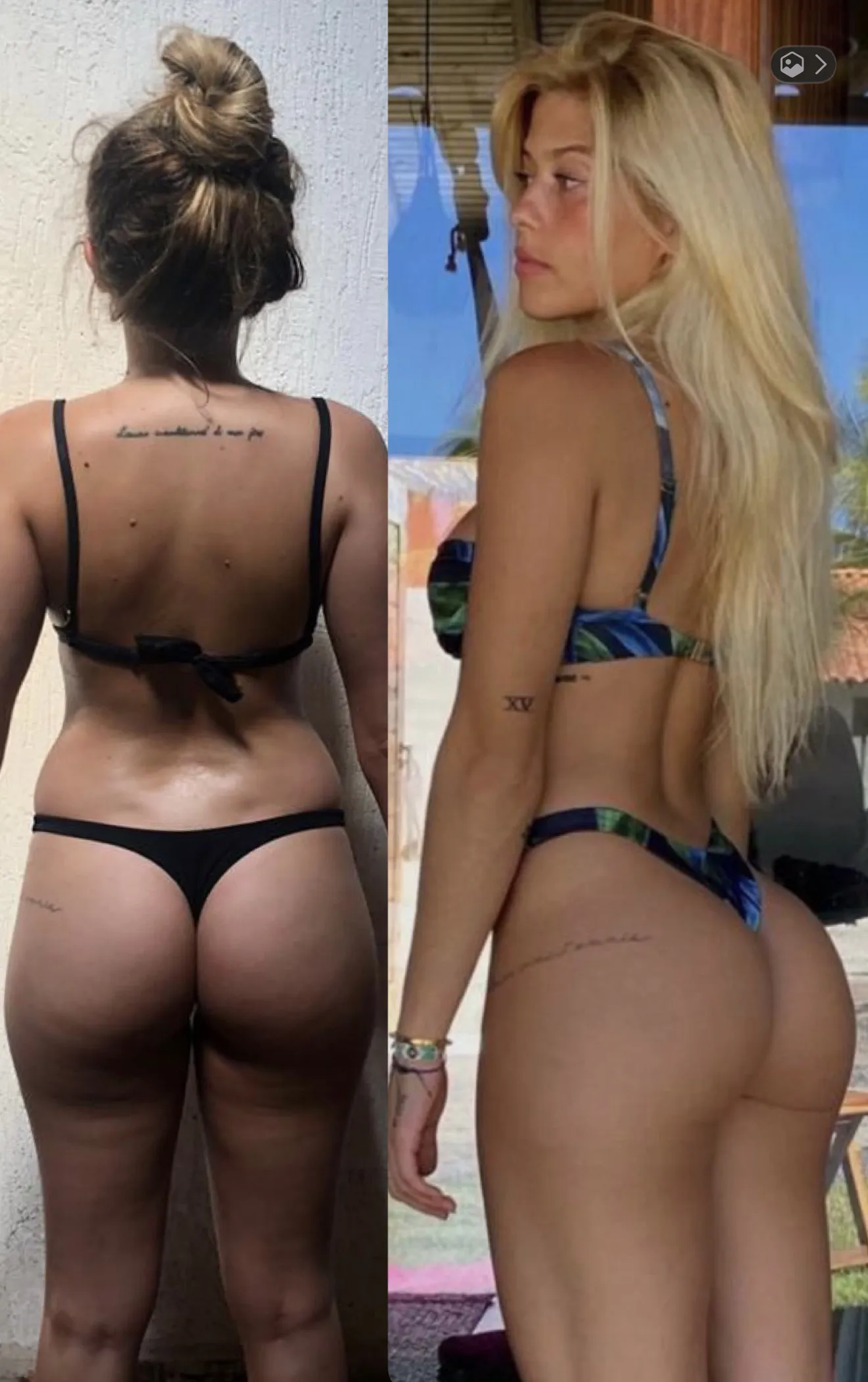Brunelli — antes e depois real
