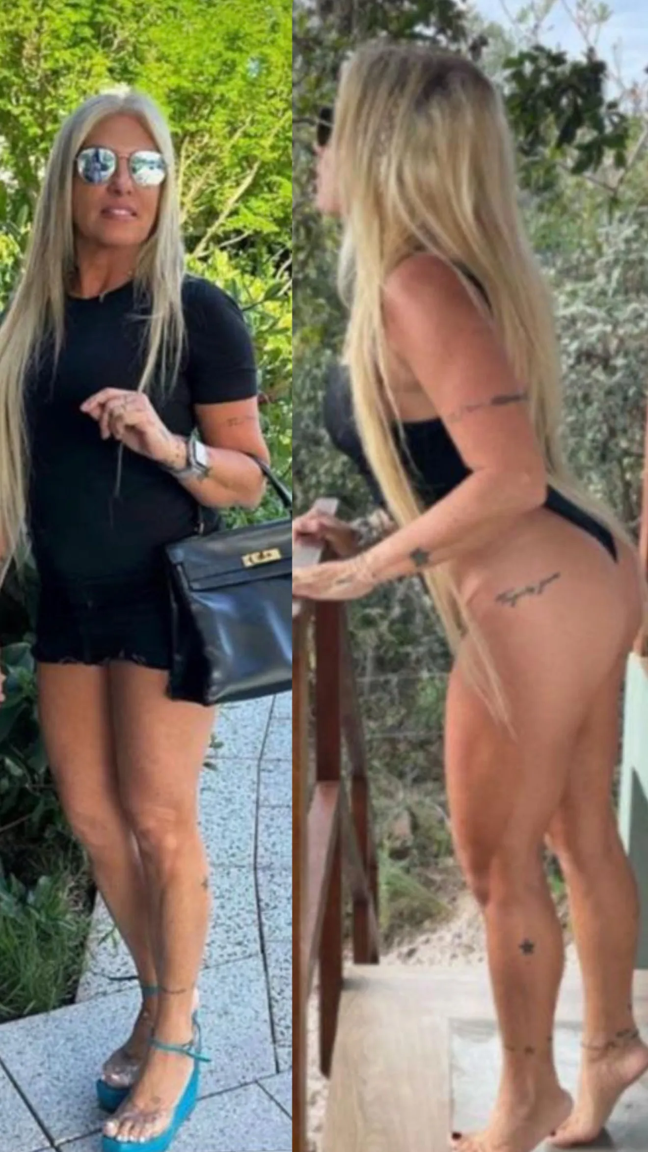 Marilene, 59 anos — antes e depois real